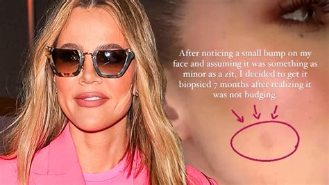 Khloe Kardashian’s Surgeon Dr. Garth Fisher Speaks Out After Removing ...