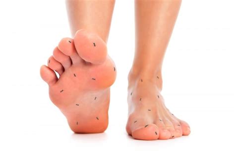 Diabetic Neuropathy is a type of nerve damage that can occur in ...