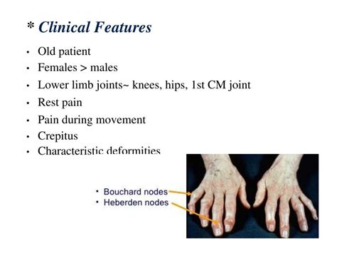 Polyarthritis (clinical approach)