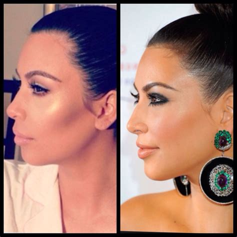 Pin by Maura McLarty on Plastic surgery | Facial contouring, Kardashian ...