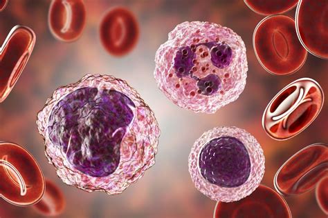 High Neutrophils and Low Lymphocytes: What Do They Mean?