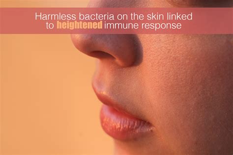 Harmless bacteria on the skin linked to heightened immune response