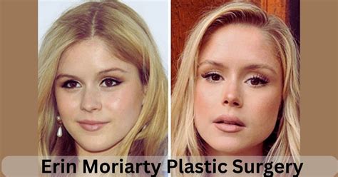 Erin Moriarty Plastic Surgery: The Truth Behind the Rumors! | Erin ...