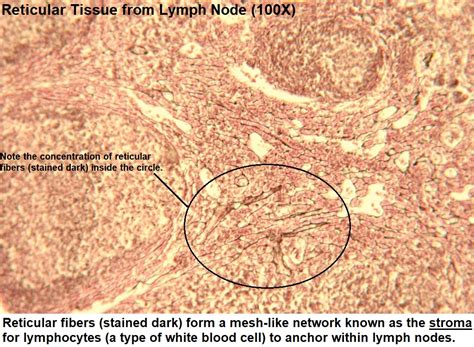 Reticular Connective Tissue Slides Labeled