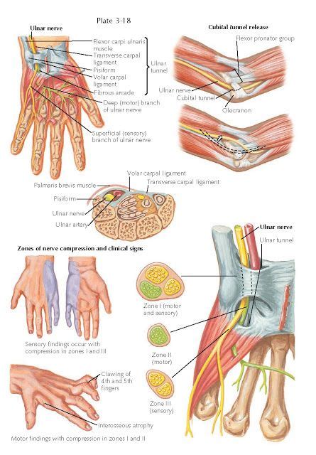 CUBITAL TUNNEL SYNDROME Ulnar nerve compression at the elbow (cubital ...