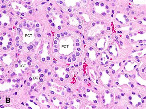 American Urological Association - Kidney: Tubules and Collecting Ducts