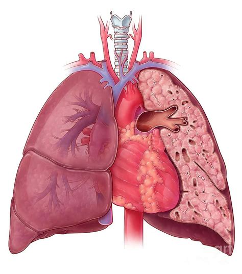 Science Photograph - Heart And Lung Anatomy, Illustration by Evan Oto ...