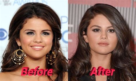 Selena Gomez | Selena gomez hair, Plastic surgery, Celebrity plastic ...