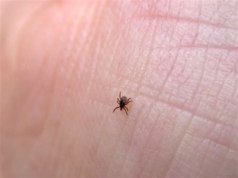 Prevent Tick Bites: 13 Things Ticks Won't Tell You | Reader's Digest