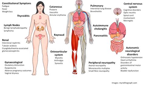 IJMS | Free Full-Text | Neurological and Inflammatory Manifestations in ...