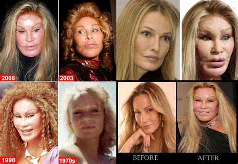 Jocelyn Wildenstein Before Plastic Surgery: Check Out Cat Face Lady ...