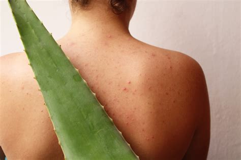 10 USES OF ALOE VERA In 2025