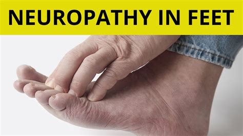 Peripheral Neuropathy Treatment | 9 Tips On How to Handle Neuropathy in ...