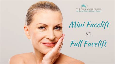 Mini Facelift vs Full Facelift