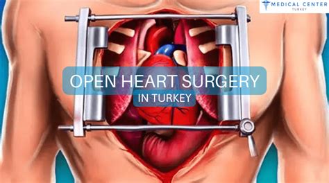 Open Heart Surgery in Turkey - MCT