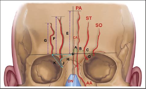 [PDF] The Arteries of the Central Forehead: Implications for Facial ...