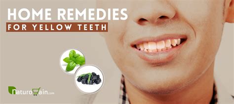 Top 10 Home Remedies for Yellow Teeth that Work [Naturally]