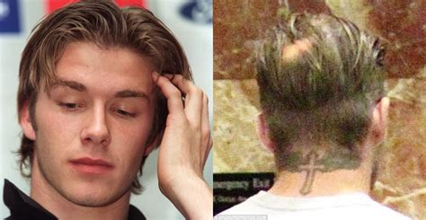 The truth behind the David Beckham hair transplant rumours - His Hair ...