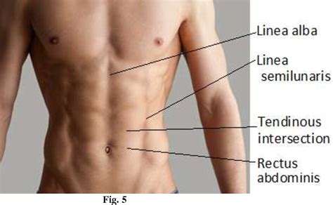 Figure 2 from Spigelian Hernias , A Diagnostic Enigma-A Case Report ...