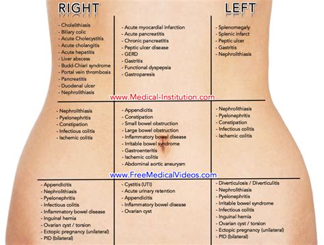 Abdominal Pain Causes By Location Stomach Anatomy And Quadrants | Hot ...