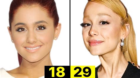 What Happened to Ariana Grande's Face? | Plastic Surgery Analysis - YouTube