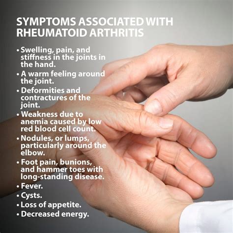 Rheumatoid Arthritis Of The Hand | Florida Orthopaeidic