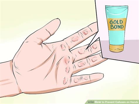 3 Ways to Prevent Calluses on Hands - wikiHow