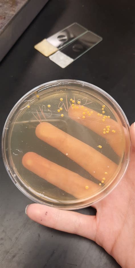 throat swab, any bacteria guesses? : r/microbiology