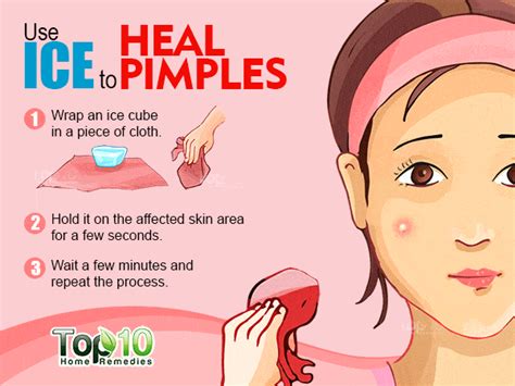 How to get rid of pimples fast | 3News