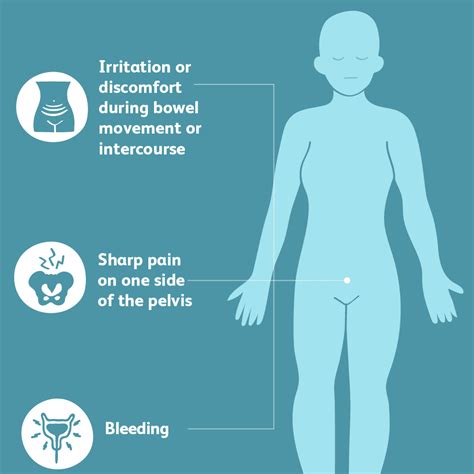 Ruptured Ovarian Cysts: Diagnosis, Treatment, and More