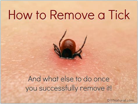 How to Remove A Tick: And What to Do Once You've Been Bitten | Ticks ...