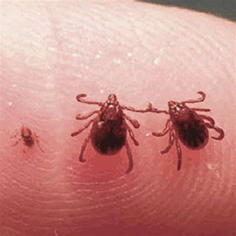 Tick Bite Pictures Symptoms What Does A Tick Bite Look