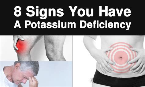 8 Signs You Have A Potassium Deficiency | Potassium deficiency, Vitamin ...