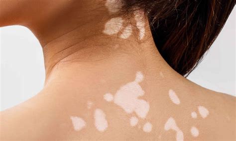 Sore Discolored Patch Of Skin: Potential Causes | Heidi Salon