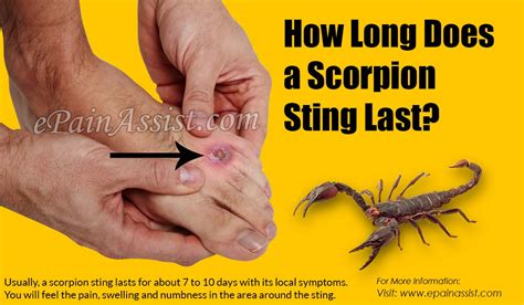 How Long Does a Scorpion Sting Last & what To Do If You Get Stung By a ...