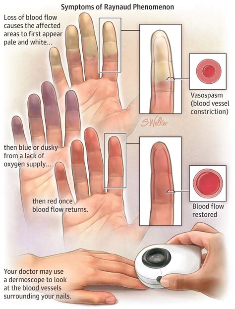 Pin on Fundamentals of nursing