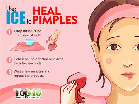 Best Ways To Get Rid Of Pimples at Home