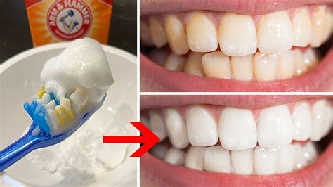 Does Baking Soda Really Help Whiten Teeth? – the BEAUTIOUS