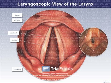 Laryngoscopic View of the Larynx - TrialQuest Inc.