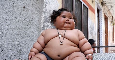 Morbidly obese baby weighs nearly 3st at just eight months old - Daily Star