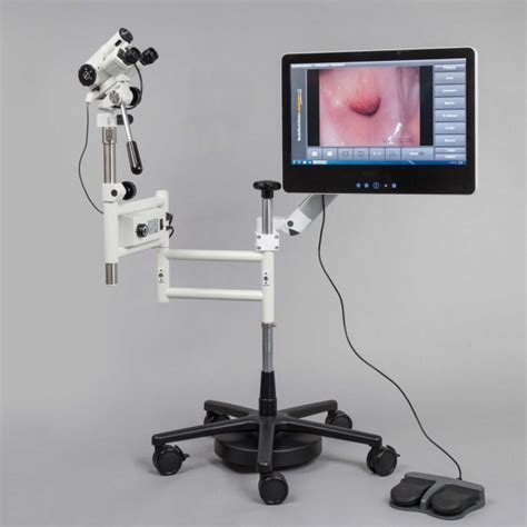 Colposcopy