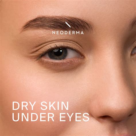 Dry Skin Under Eyes – NEODERMA