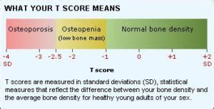 Bone Density (DEXA) - Peninsula Imaging