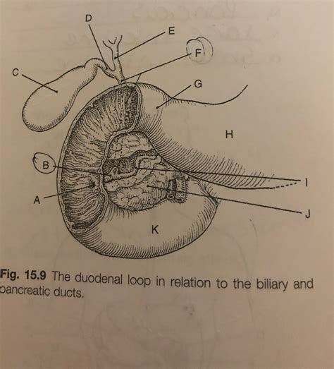 duodenal loop Diagram | Quizlet