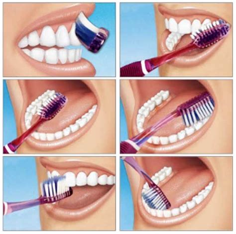 Brushing Technique