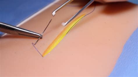 Subcuticular Suture - OSCE guide | Surgical Skills | Geeky Medics