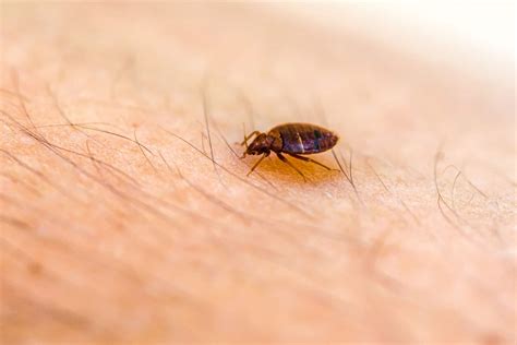 Why Homemade Remedies For Bed Bugs Are Dangerous - The Silver Words