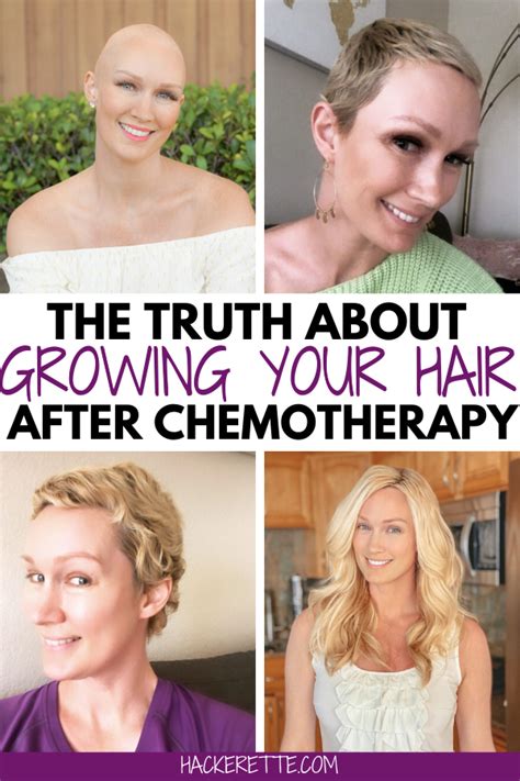 Chemotherapy Hair Loss Timeline