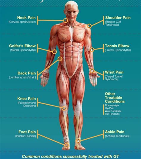 Self Graston Therapy for Knee Hip Pain Plantar Fasciitis