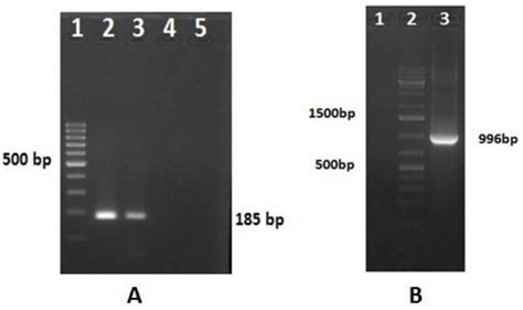 RT-PCR-amplified products of RV-D. (A) Lane 1: 100-bp DNA ladder ...